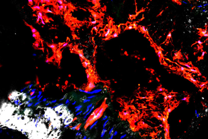 A new study indicates that stem cells called Gli1 cells (shown in red) are responsible for depositing calcium in the arteries, increasing the risk of atherosclerosis. Over time, the condition can lead to cardiovascular disease and is especially common in patients with chronic kidney disease. The research may help scientists find ways to prevent hardening of arteries. (Image: Humphries Lab)