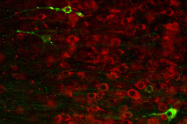 Drug compound halts Alzheimer’s-related damage in mice