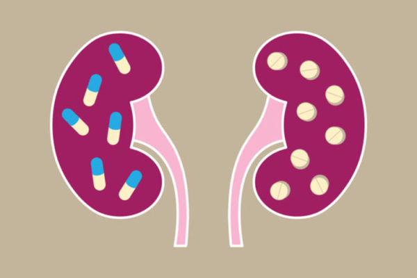 Popular heartburn drugs linked to gradual yet ‘silent’ kidney damage