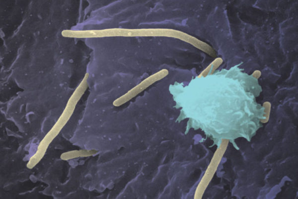 Aggressive UTI bacteria hijack copper, feed off it