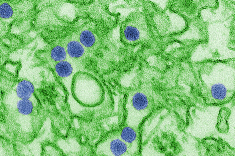 Zika virus under a microscope