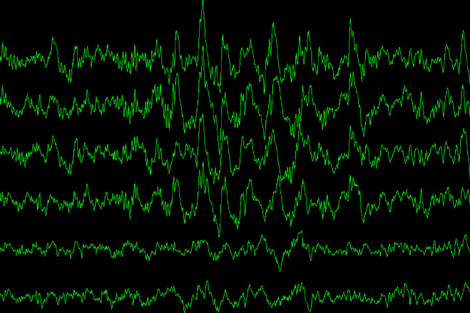 brain waves during sleep