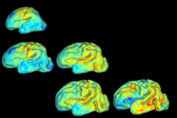 3-D mapping babies’ brains