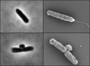 Mutant E. coli bacteria