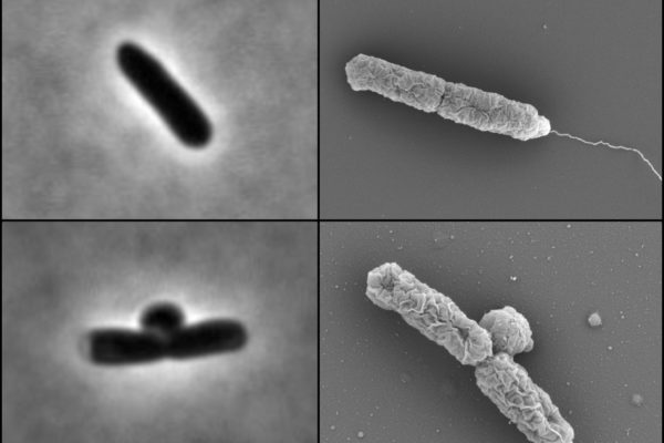 Specialist enzymes make E. coli antibiotic resistant at low pH