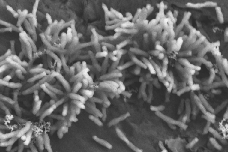 전자 (electron)를 세포내로 보내 탄소를 고정하는 광합성 세균 Rhodopseudomonas palustris