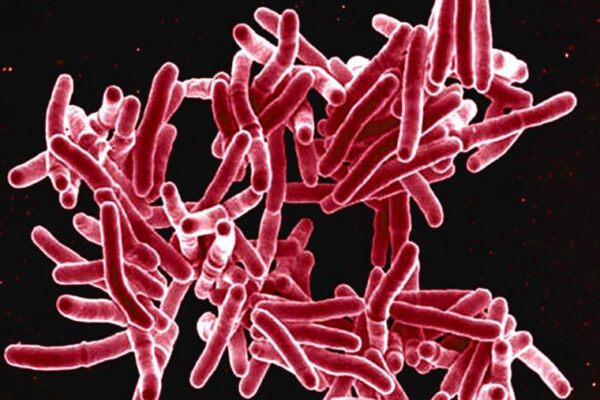 Drug-resistant tuberculosis reversed in lab