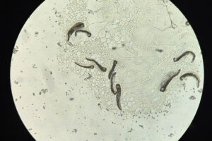 gregarine parasites