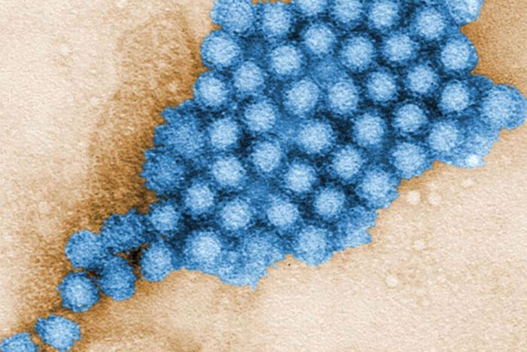 Norovirus particles show up blue against a beige background