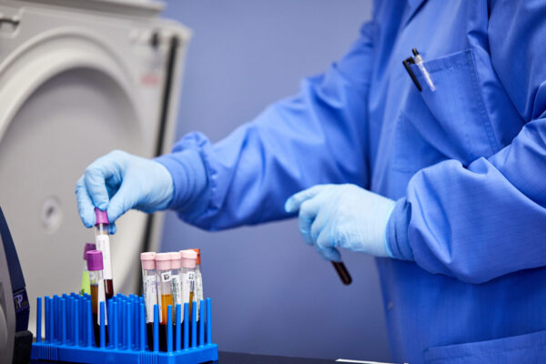 Experts urge caution in interpreting COVID-19 antibody tests