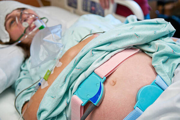For moms, oxygen during childbirth often unnecessary