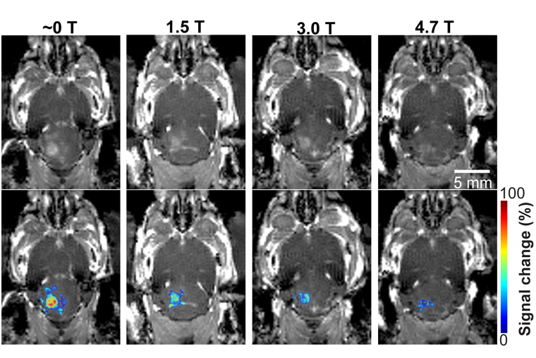 Ultrasound images of mri-guided focused ultrasound-induced blood brain barrier opening