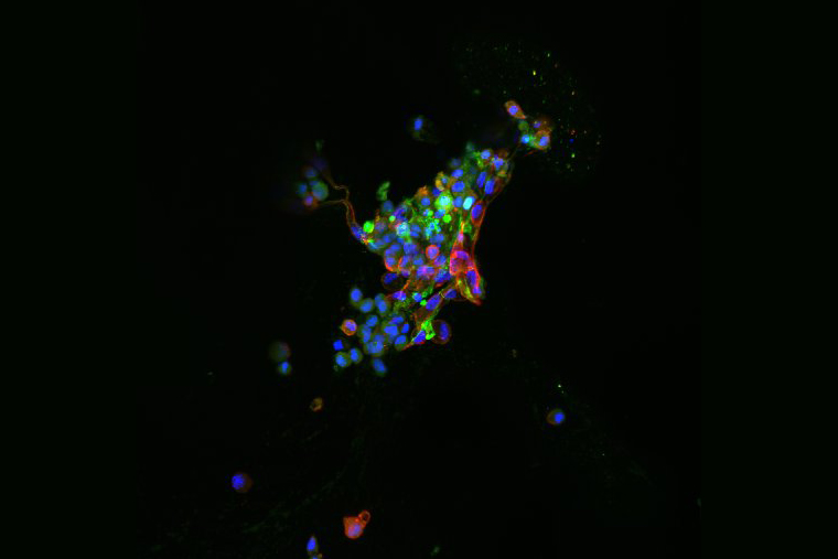 Image of cells lit up with fluorescence