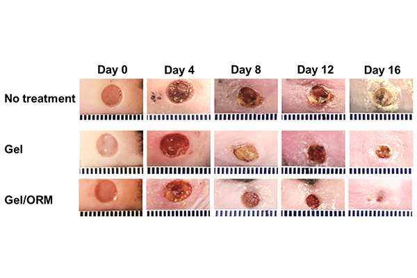 images of diabetic ulcers in different stages of healing