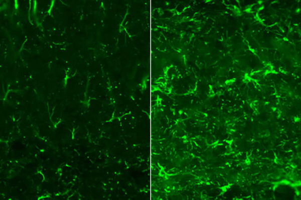 New strategy reduces brain damage in Alzheimer’s and related disorders, in mice
