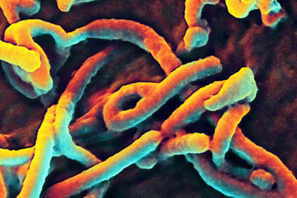 Rapid Ebola diagnosis may be possible with new technology
