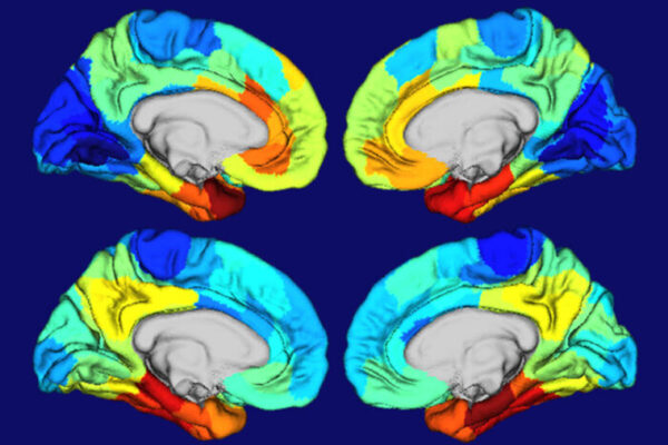 Study yields clues to why Alzheimer’s disease damages certain parts of the brain
