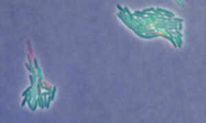 microscope image of E. coli in fluorescent green