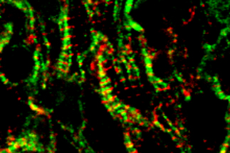 image of green and red striped bands of muscle proteins called sarcomeres